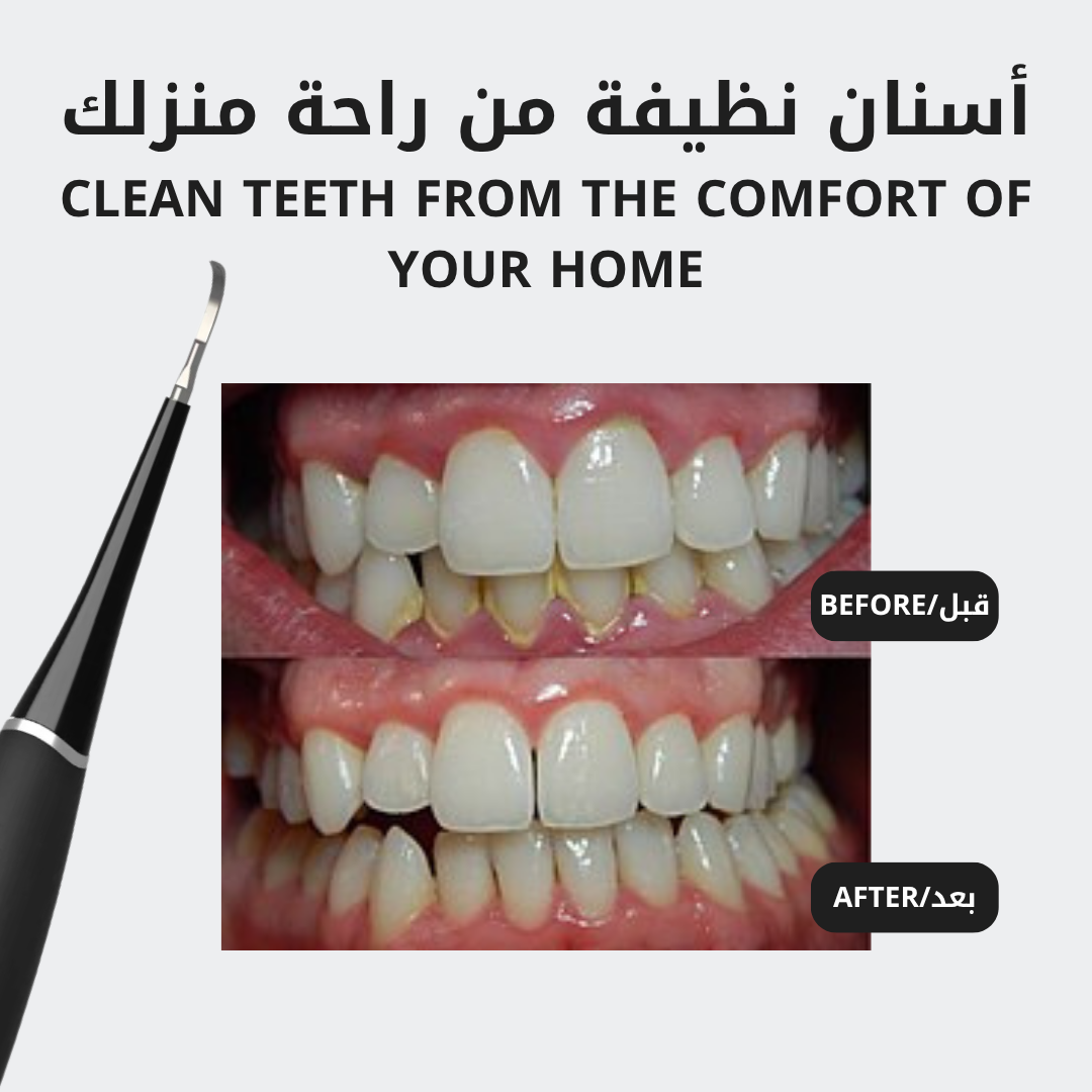 جهاز إزالة الجير