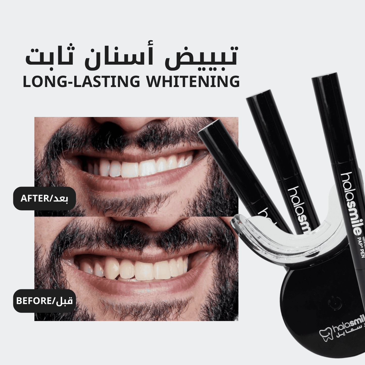 باقة ٢ - جهاز تبييض الاسنان