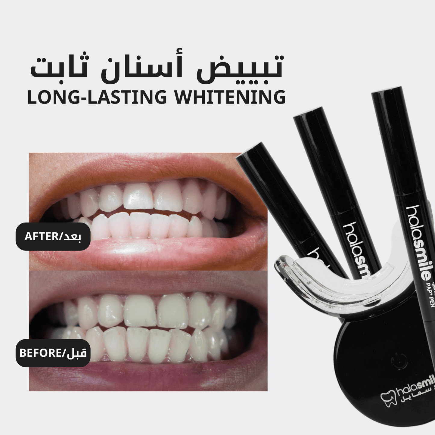 White & Fresh Bundle