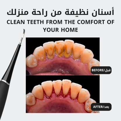 عدة الابتسامة الكاملة